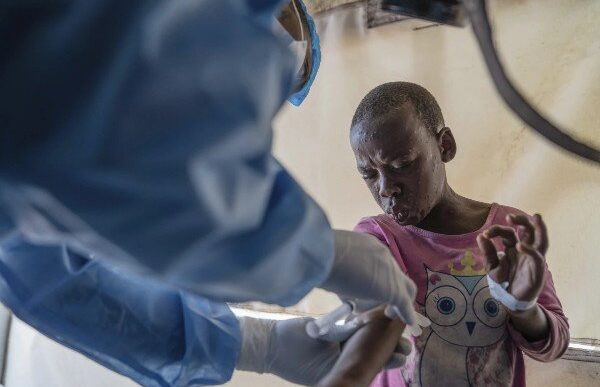 A Mpox patient receiving treatment in the DRC.