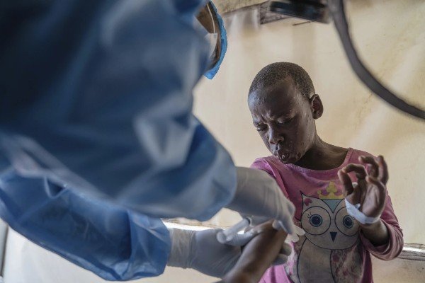 A Mpox patient receiving treatment in the DRC.