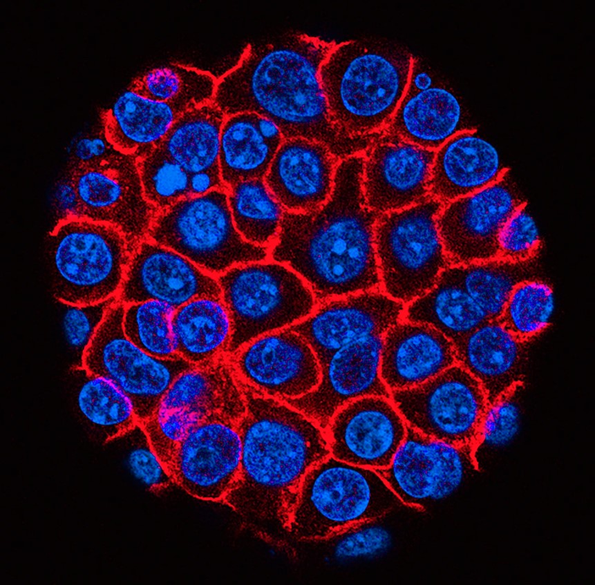 In this fluorescence micrograph, pancreatic cancer cells (nuclei in blue) form a spherical cluster encased in membranes (red). Researchers use these lab-grown models to study how mutations like KRAS drive tumor growth and to test drugs that block those signals. USC Norris Comprehensive Cancer Center/National Cancer Institute/Science Photo Library