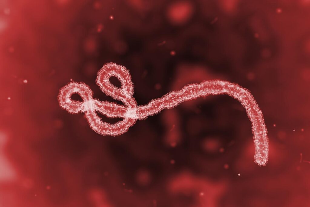 caption for a microscopic ebola virus 12:55 A microscopic image of the Ebola virus